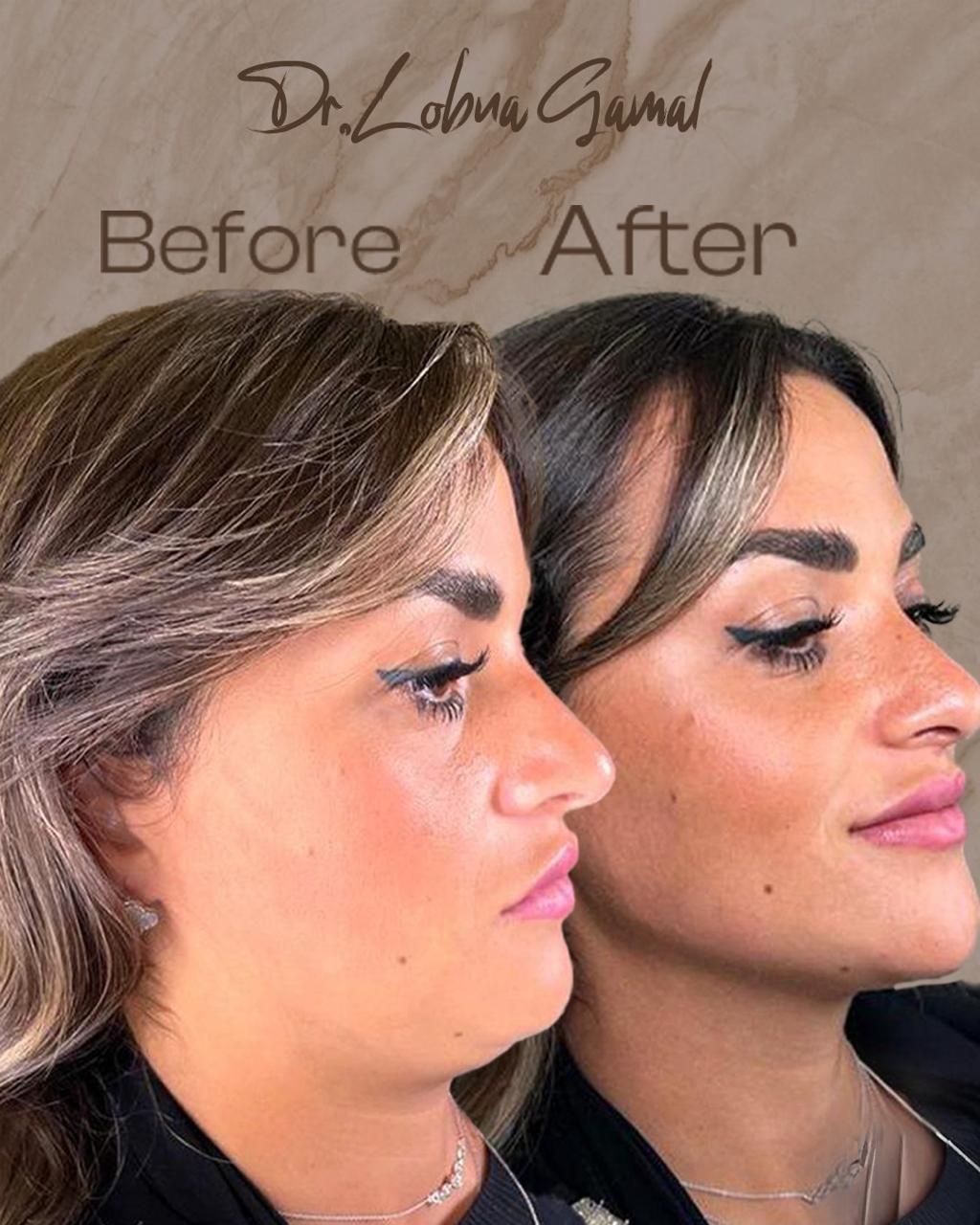 Treatment Result
